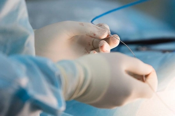 Dikişli Yara Belirtileri ve Tedavisi Dikişli Yara Belirtileri ve Tedavisi