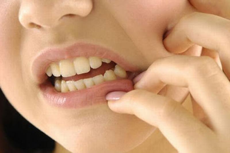 Ağız İçi Yaraları Belirtileri ve Tedavisi